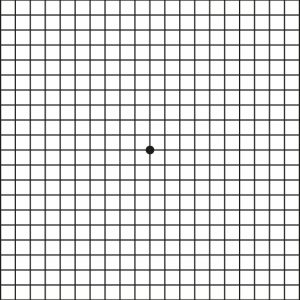 Das Amsler-Gitter